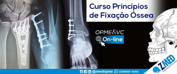 Curso Princípios de Fixação Óssea on-line